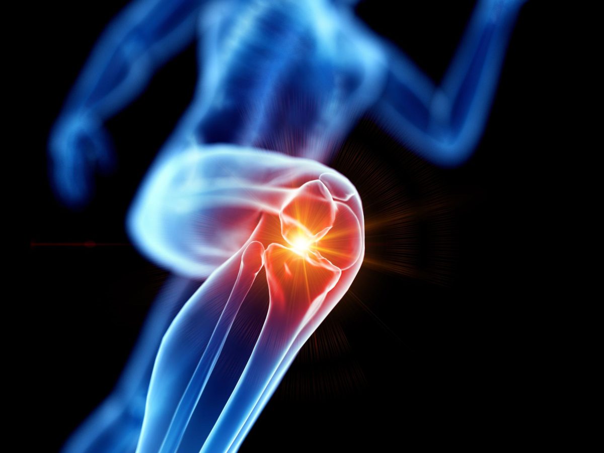 Innovations in AI are helping to cure ACL injuries, effectively integrating new technology in the future of healthcare. 